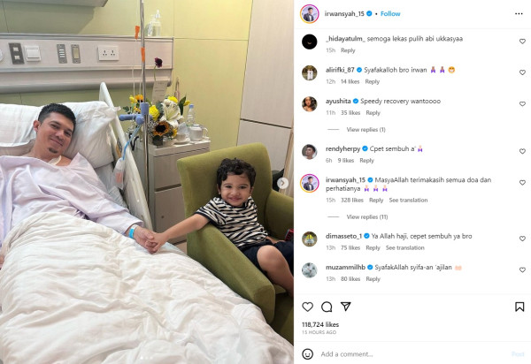 Tangan Irwansyah Patah Gegara Jatuh saat Berkuda, Begini Kondisinya