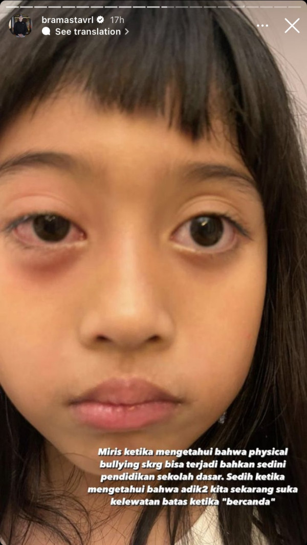 Verrell Bramasta Emosi Adiknya Jadi Korban Bully di Sekolah, Mata Bengkak Dilempar Batu
