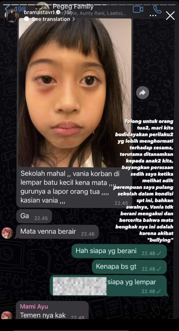 Verrell Bramasta Emosi Adiknya Jadi Korban Bully di Sekolah, Mata Bengkak Dilempar Batu