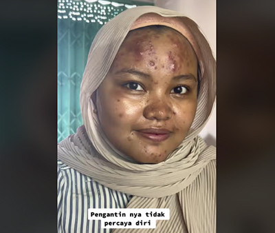 Viral! MUA Sukses Rias Pengantin Berwajah Penuh Jerawat Batu Jadi Mulus dan Bikin Pangling