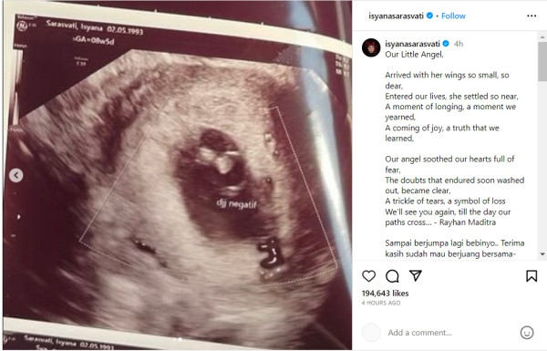 Isyana Sarasvati Alami Keguguran di Usia Kandungan 8 Minggu