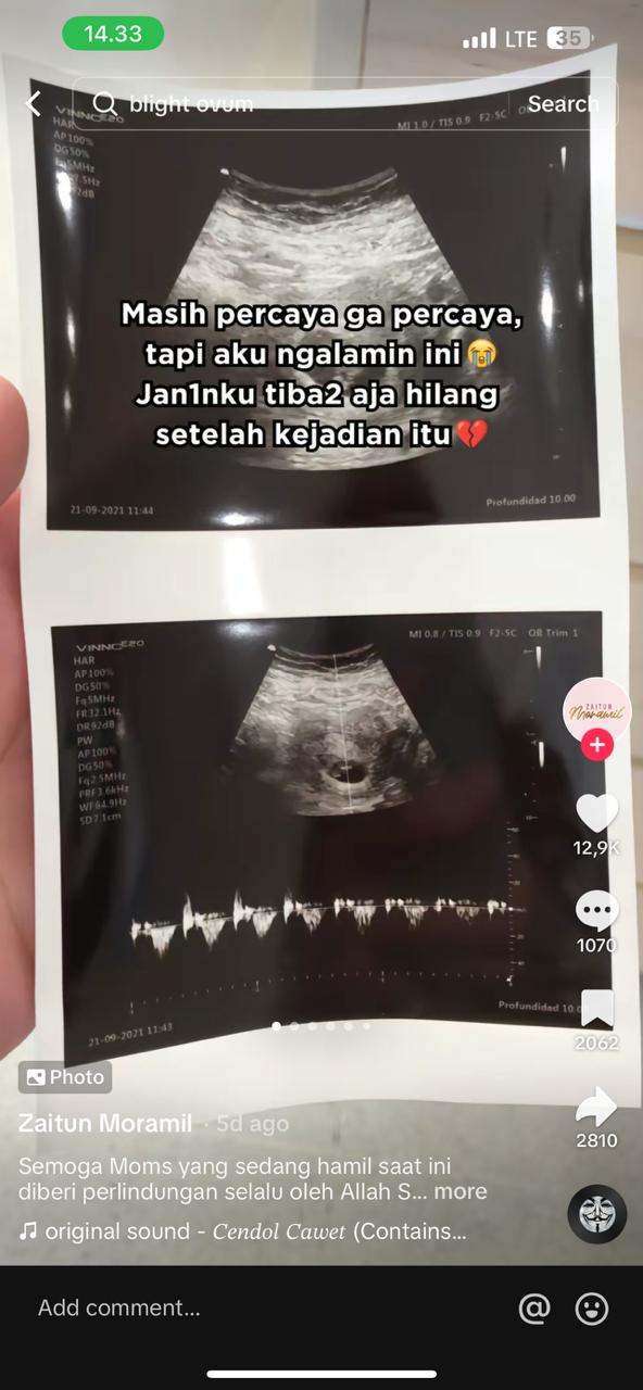 Viral! Wanita Curhat Kehilangan Janin di Kandungannya usai Keluar saat Maghrib, Kisahnya Pilu