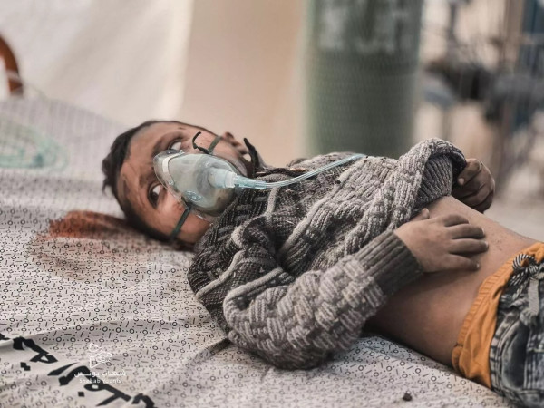 Warga Gaza Ungkap Horor Nyata Akibat Hujan Rudal-rudal Israel