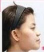 Viral! Istri Batal Diceraikan Suami Gegara Jadi Cantik usai Operasi Plastik