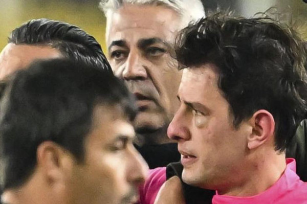 Edan! Wasit Dikeroyok di Lapangan, Liga Turki Dibekukan