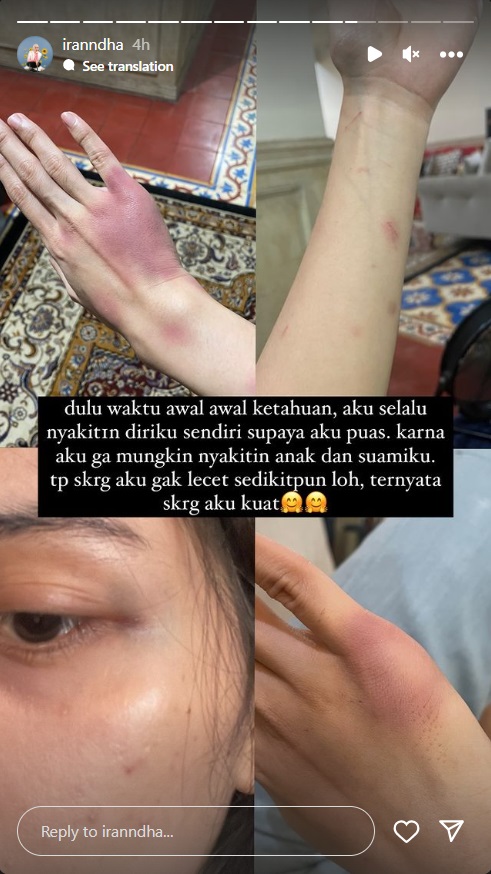 Ira Nandha Sempat Sakiti Diri Sendiri usai Pergoki Suami Selingkuh dengan Pramugari