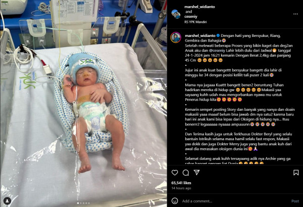 Marshel Widianto dan Cesen Sambut Kelahiran Anak Kedua