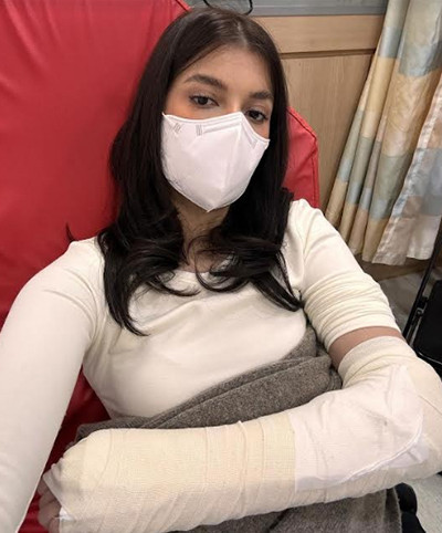 Pergelangan Tangan Shabrina Chairunnisa Retak saat Liburan Sendiri ke Korea