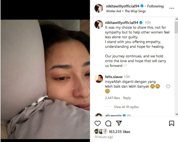 Kronologi Nikita Willy Keguguran, Rasakan Bahagia saat Hamil Anak Kedua