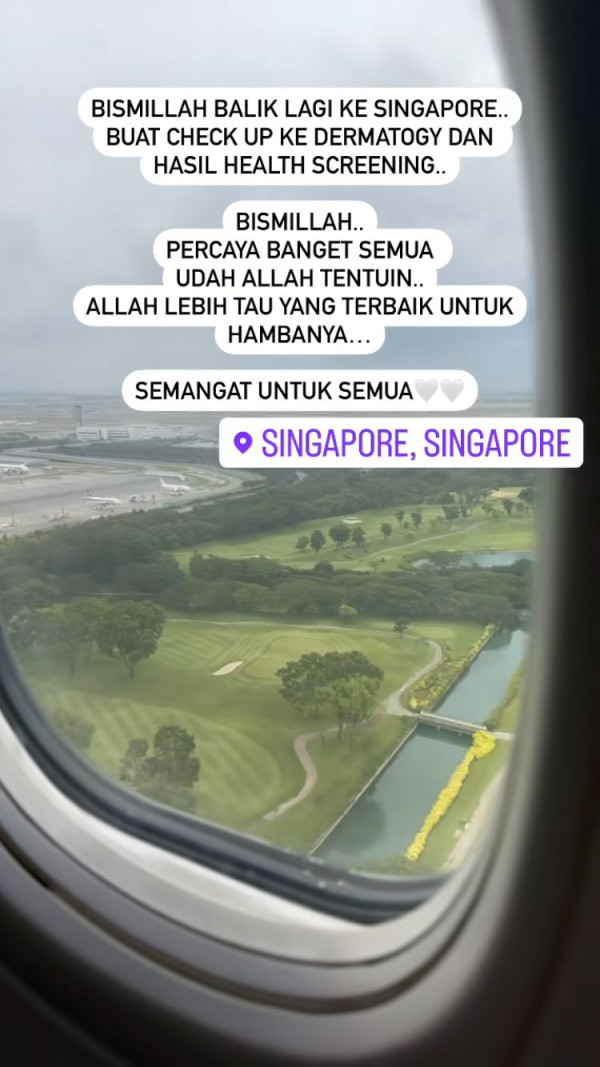 Kartika Putri Bertolak ke Singapura, Kembali Jalani Pengobatan Wajah yang Melepuh