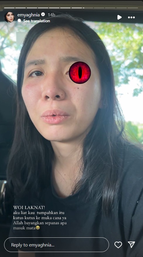 Aghnia Punjabi Ungkap Anaknya Dipukul Buku dan Diguyur Minyak Gosok oleh Pengasuh
