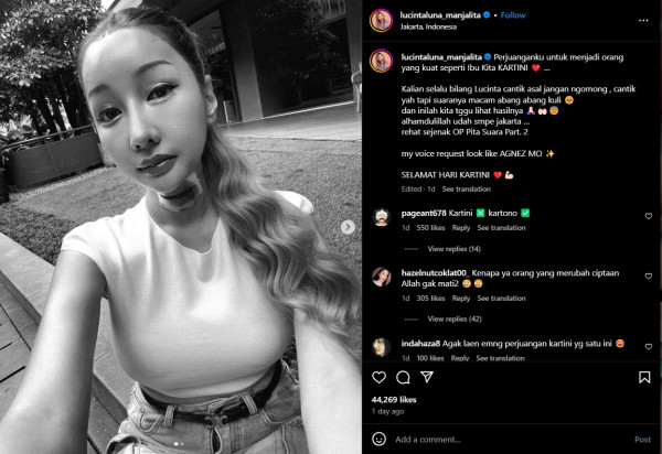 Lucinta Luna Pamer Leher Diperban usai Operasi, Kesal Suaranya Sering Disebut Mirip Abang-abang