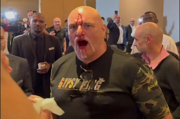 Sundul Anggota Tim Usyk, Jidat Ayah Tyson Fury Berlumuran Darah