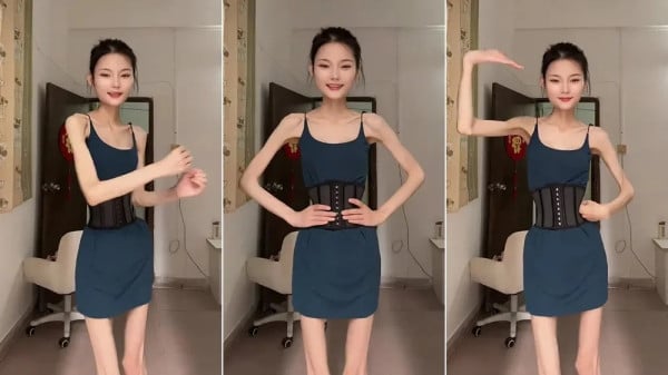 Viral! Wanita Ini Punya Berat Badan 25 Kg, tapi Masih Ingin Kurus Lagi