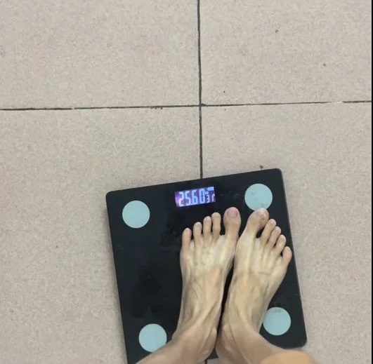 Viral! Wanita Ini Punya Berat Badan 25 Kg, tapi Masih Ingin Kurus Lagi