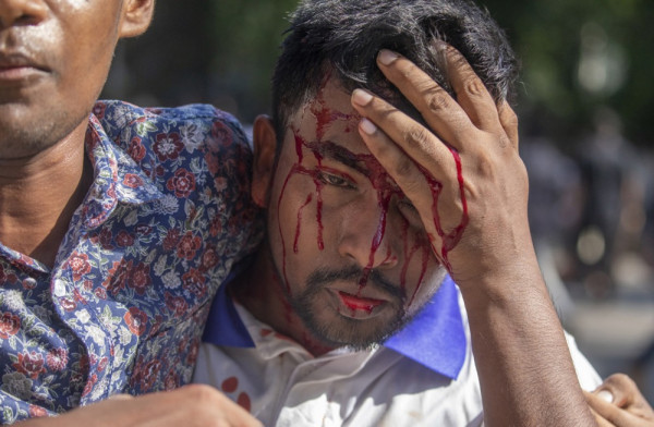 Siapa Razakar? Kekuatan Kolaborator yang Dikendalikan Pakistan dan Ingin Bangkit untuk Mengguncang Bangladesh
