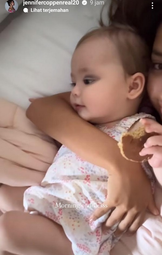 Jennifer Coppen Ungkap Mata Anak yang Lebam: Kepentok