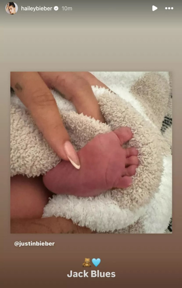Hailey Baldwin Istri Justin Bieber Melahirkan Anak Pertama