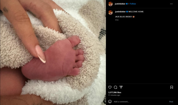 Hailey Baldwin Istri Justin Bieber Melahirkan Anak Pertama