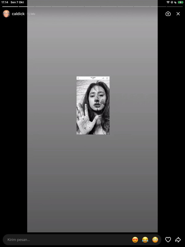 Selebgram Afifah Riyad Diduga Alami KDRT, Wajah Babak Belur Viral