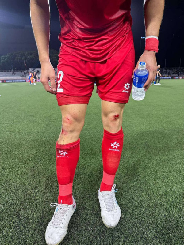 Makan Korban! Rumput Sintetis Stadion Rizal Memorial Bikin Pemain Vietnam Berdarah-darah
