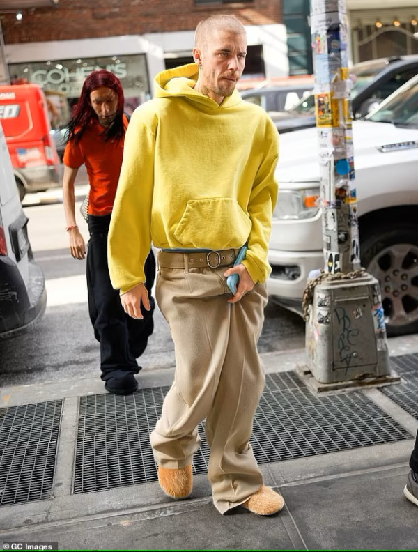Justin Bieber Makin Tak Terawat, Penampilannya Lusuh dan Kurus