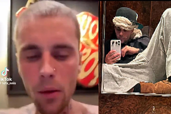 Justin Bieber Disebut Tidak Waras, Video Terbarunya Buat Penggemar Cemas