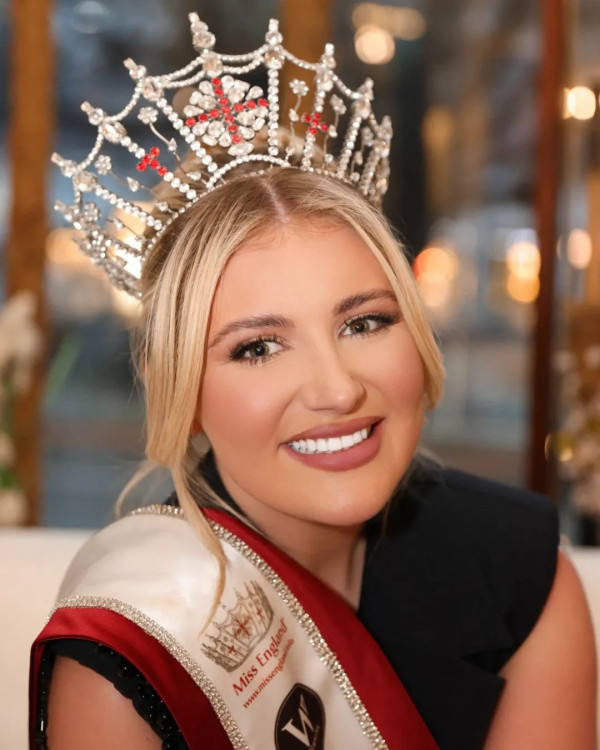5 Potret Cantik Miss England Milla Magee yang Mundur dari Miss World 2025