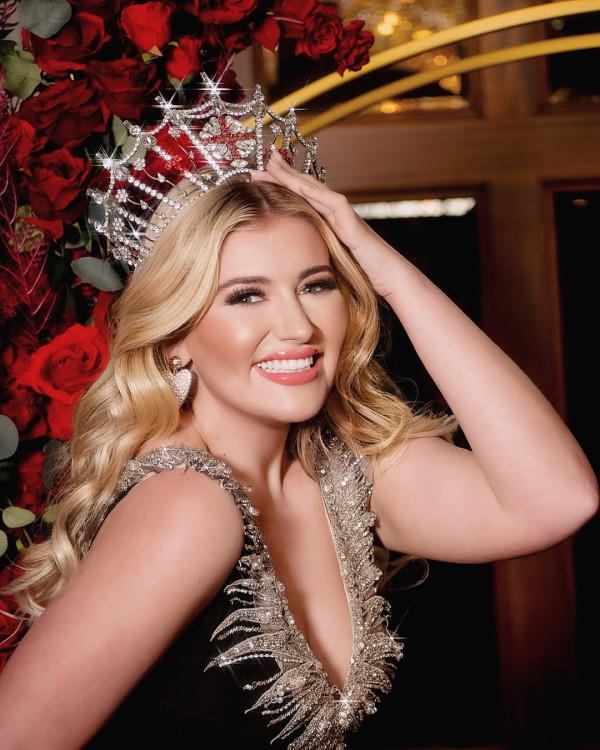5 Potret Cantik Miss England Milla Magee yang Mundur dari Miss World 2025
