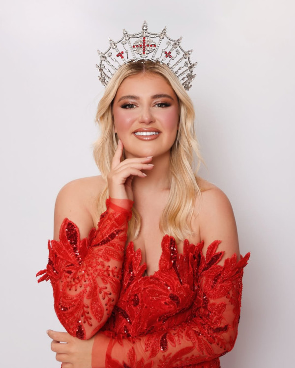 5 Potret Cantik Miss England Milla Magee yang Mundur dari Miss World 2025