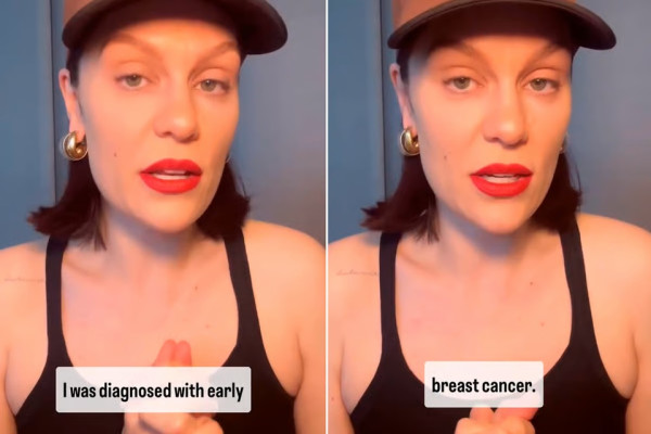 Jessie J Didiagnosis Idap Kanker Payudara Stadium Awal