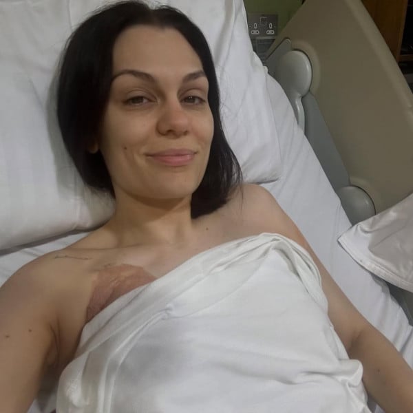 Jessie J Jalani Operasi Kanker Payudara, Curhat Momen 48 Jam yang Berat