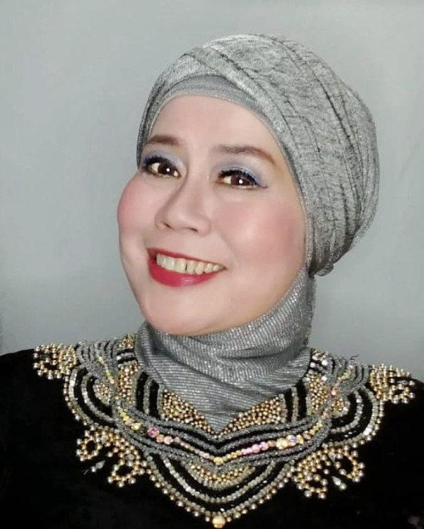 Dewi Yull Alami Kebutaan Sebelah, Retina Mata Kanan Lepas Akibat Minus Tinggi