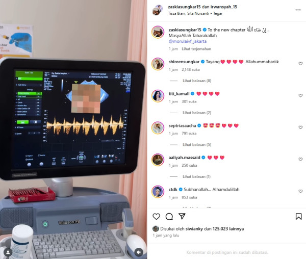 Zaskia Sungkar Umumkan Kehamilan Kedua, Terharu Dengar Detak Jantung Bayi