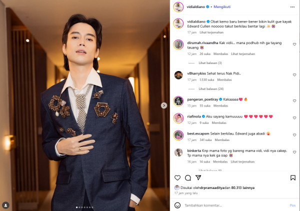 Vidi Aldiano Ungkap Efek Kemoterapi pada Kulit: Gue Kayak Edward Cullen