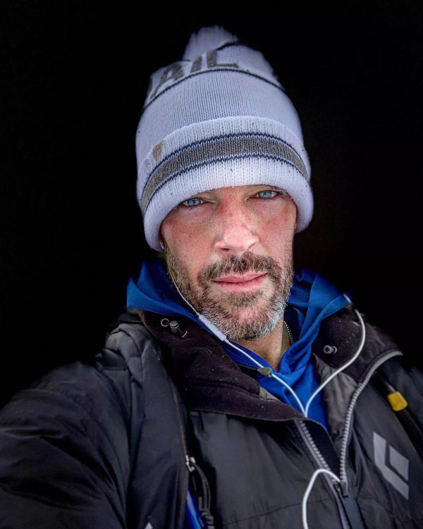 12 Artis Hollywood Mengidap Penyakit Lyme, Kondisi Bella Hadid Mengkhawatirkan