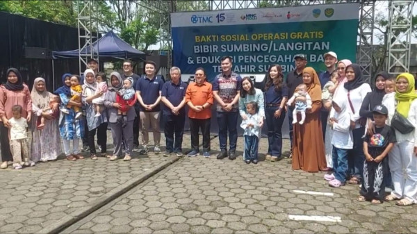 MNC Peduli dan RS TMC Tasikmalaya Gelar Operasi Bibir Sumbing Gratis